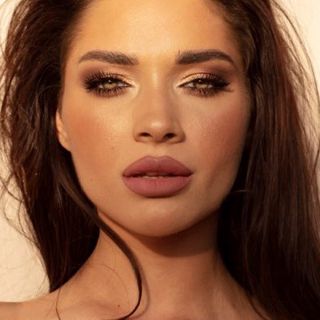 Top Trends in Russian Lip Fillers