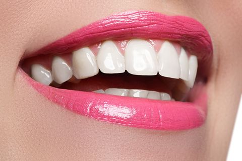 Call Now for the Best Composite Veneers Cost in Dubai