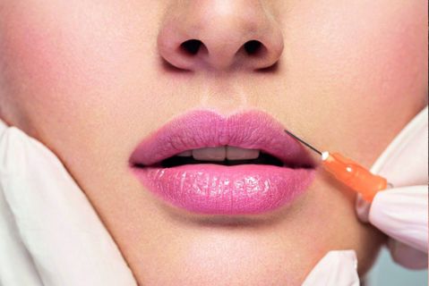 How to Avoid Overfilled Lips