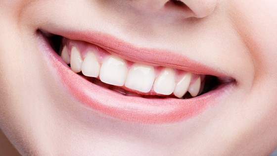 Zoom Teeth Whitening: Ideal for Dubai's Climate and Lifestyle