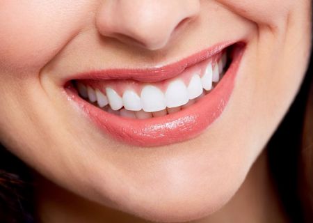 Comparing Teeth Whitening Prices Across Dubai Clinics