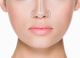 Rhinoplasty Muscat Recovery And A Comprehensive Guide to Post-Surgery Care