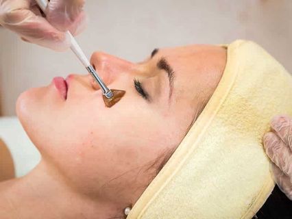 Brighten Your Skin Tone: PCA Peel Dubai Insights