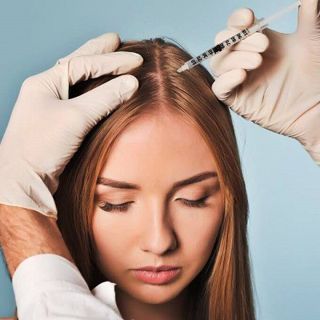 PRP Hair Therapy in Dubai  after c-section