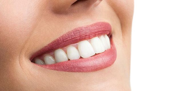 A Comprehensive Guide to Teeth Whitening Prices in Dubai