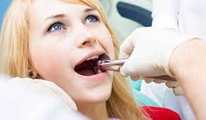 How to Navigate Wisdom Tooth Extraction Costs in Dubai’s Dental Market