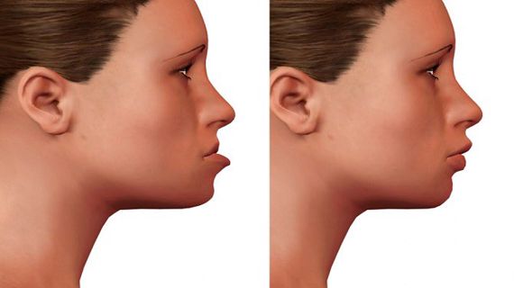 How Oral and Maxillofacial Surgery Can Help with Chronic Facial Pain