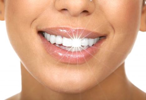 Teeth Whitening: Boost Your Smile's Radiance