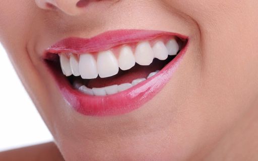 Cheap Teeth Whitening in Dubai