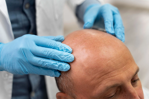 How Long Does Recovery Take After FUE in Dubai?