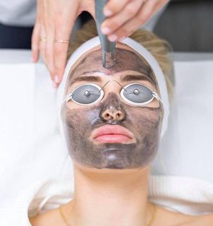 How Spectra Laser Carbon Peel Can Improve Your Skin Health