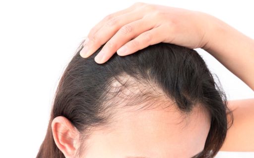 Cost and Availability of Finasteride for Hair Loss Treatment in the UAE