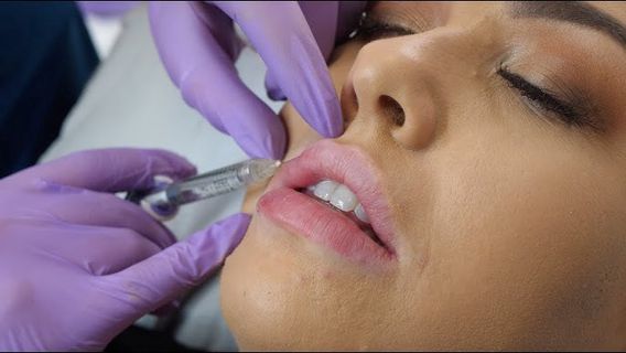 Best Lip Filler Deals in Dubai