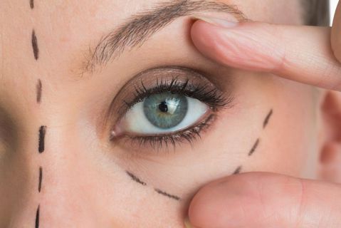 Eyelid Xanthelasma Removal What to Expect During Treatment