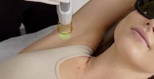 Exploring New Innovations in Underarm Whitening Treatments