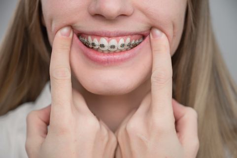 Orthodontic Price Trends in Dubai What You Need to Know Before You Start