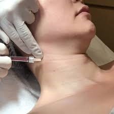 Achieve a Sleek Neck: Botox Injections in Dubai for a Youthful Look