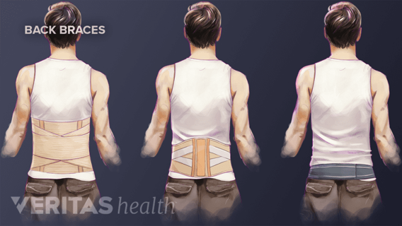 When Should You Use Back Brace Support for Pain Relief?