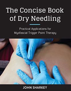 [READ] [PDF EBOOK EPUB KINDLE] The Concise Book of Dry Needling: A Practitioner's Guide to Myofascia