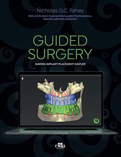 Get [EPUB KINDLE PDF EBOOK] GUIDED SURGERY: Making implant placement simpler by  Nicholas G.C. Fahey