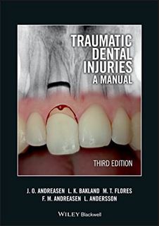 READ EBOOK EPUB KINDLE PDF Traumatic Dental Injuries: A Manual by  Jens O. Andreasen,Leif K. Bakland