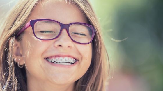How will Wearing Braces Change Your Face Look?