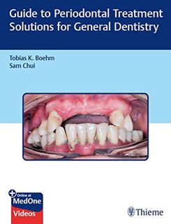 Get [EPUB KINDLE PDF EBOOK] Guide to Periodontal Treatment Solutions for General Dentistry by  Tobia
