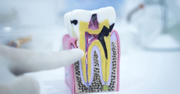 Know About The Tips to Fix Teeth Without Enamel
