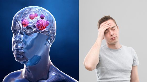 What is the Difference Between Migraine and Brain Tumor Symptoms?