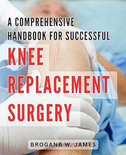 Read A Comprehensive Handbook for Successful Knee Replacement Surgery: The Ultimate Guide to Achievi