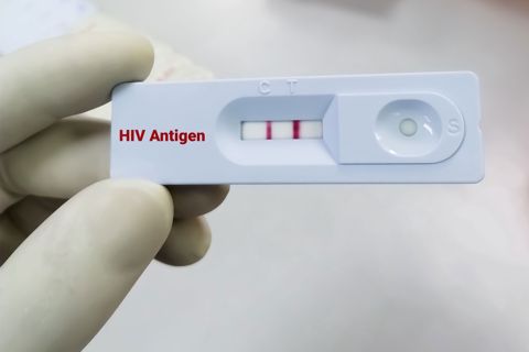 Timelines and Factors Affecting HIV Detection via Blood Test