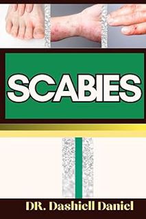 Read SCABIES: Expert Guide To Understanding Scabies Causes, Symptoms, Preventing, Treatment for opti