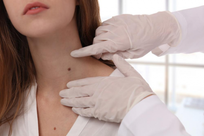 Smooth and Trustworthy Mole Removal: Dubai's Solution for Flawless Skin?