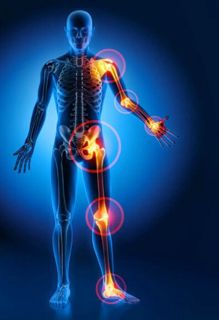 Arthritis: Symptoms, Causes and Treatment options