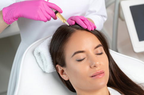 Unveiling the Power of Platelet-Rich Plasma (PRP) for Hair Regrowth in Dubai