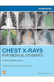 PDF FREE Chest X-Rays for Medical Students: CXRs Made Easy by Christopher Clarke