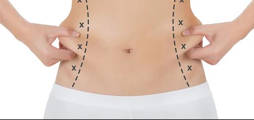 Elevate Your Image: Liposuction Cost Guide for Abu Dhabi Residents